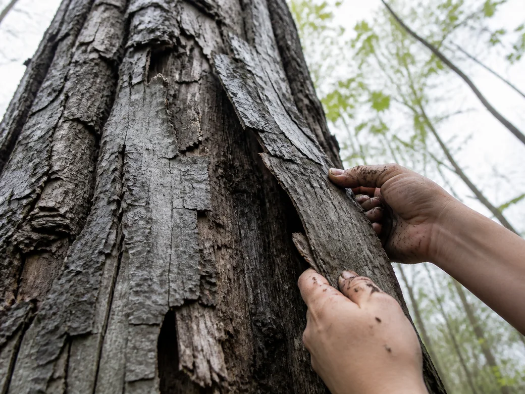 Two bare hands lifting a loose slab of gray bark away from the trunk of a dying elm that still carries a few leaves high above