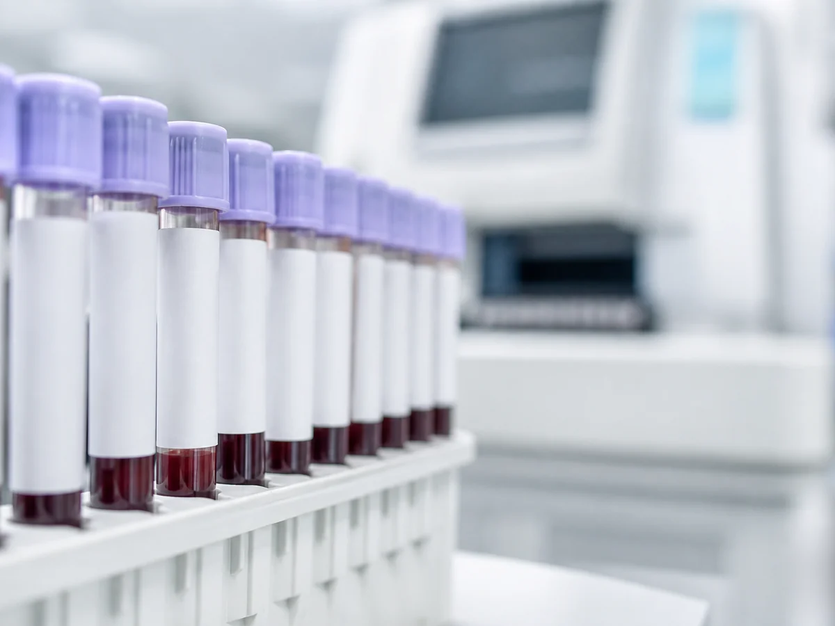 Rack of labeled blood sample tubes in a laboratory with an analyzer out of focus behind them