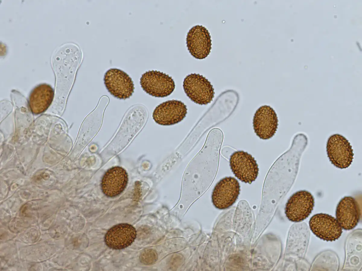 Ornamented Gymnopilus spores and cystidia under a microscope