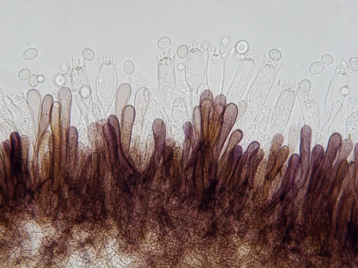 Pigmented blackedge bonnet gill-edge cells under a microscope