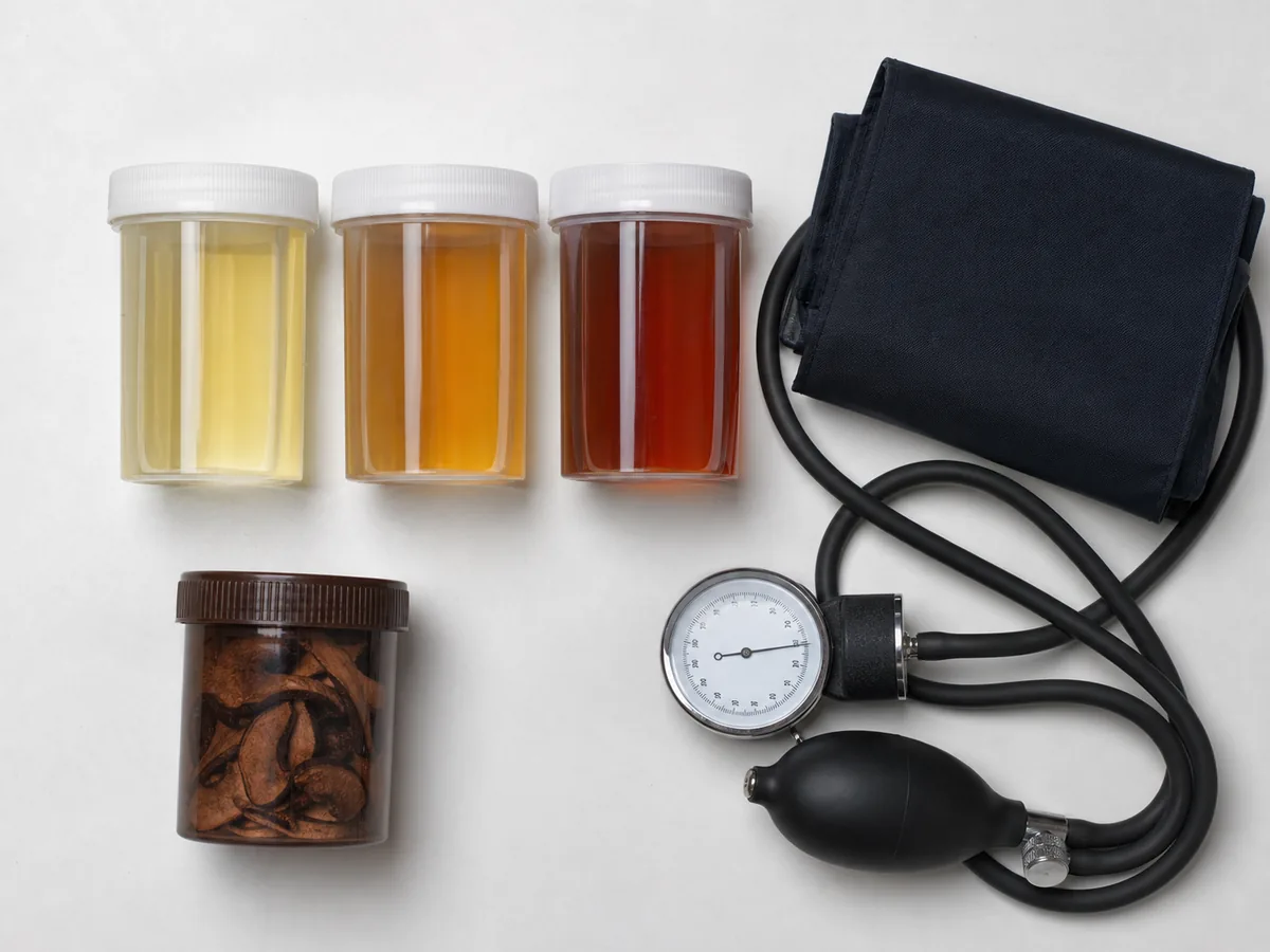 Urine-color sample vessels beside a blood pressure cuff and sealed mushroom specimen